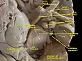 Cerebral peduncle, optic chasm, cerebral aqueduct. Inferior view. Deep dissection.