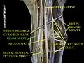 Ulnar nerve