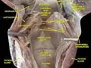 Larynx, pharynx and tongue.Deep dissection, posterior view.