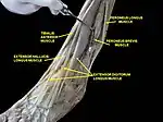 Muscles of Leg (lateral view, deep dissection)