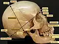 The porion.Human skull.