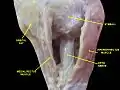 Extrinsic eye muscle. Nerves of orbita. Deep dissection.