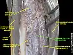 Extensor pollicis brevis muscle