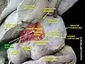 Epiploic foramen