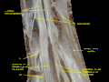 Spinal cord. Spinal membranes and nerve roots.Deep dissection. Posterior view.