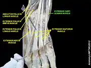 Extensor carpi ulnaris muscle