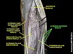 Extensor digitorum muscle