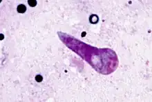 Kinete stage of Theileria parva in the transmitting tick Rhipicephalus appendiculatus