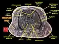 Transverse section of thorax featuring subscapularis muscle