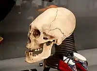 Tiwanaku skull from Bolivia, on display in the Horniman Museum, London