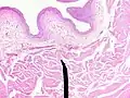 Layers of the bladder wall and cross-section of the detrusor muscle