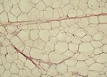 White adipose tissue in paraffin section