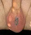 Scrotum or scrotal piercing, also called a Hafada piercing: Scrotal ladder piercing with rings