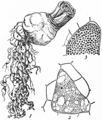 EB1911 - Finger-and-Toe (Plasmodiophora Brassicae).jpg