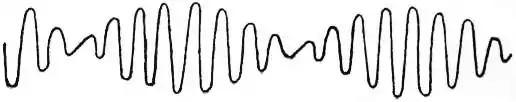 EB1911 - Induction Coil - Fig. 4.jpg