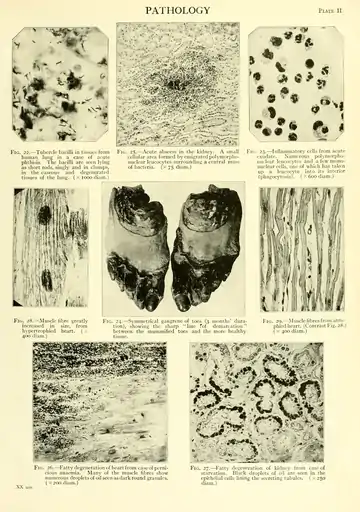 EB1911 - Volume 20.djvu-985.png