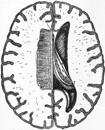 EB1911 Brain Fig. 12-Right ventricle.jpg