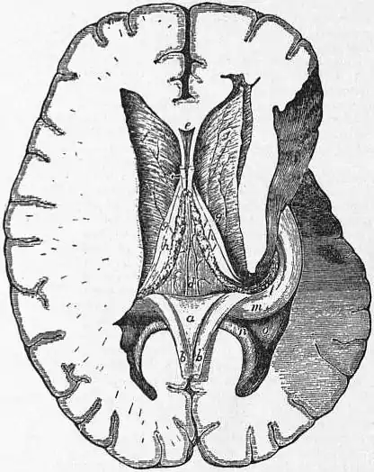 EB1911 Brain Fig. 13-Lateral ventricle.jpg