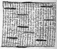 EB1911 Connective Tissues - Fig.11.png