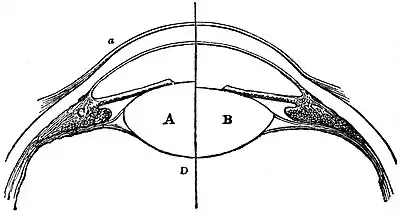 EB1911 Vision - Mechanism of Accommodation.jpg