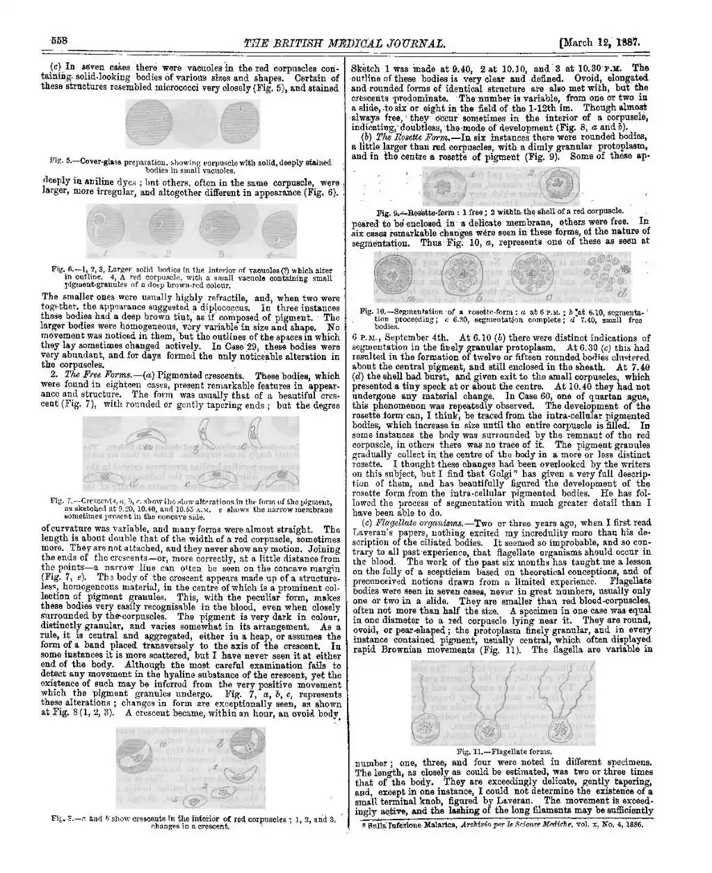 Fig. 5.—Cover-glass preparation, showing corpuscle with solid, deep stained bodies in small vacuoles.