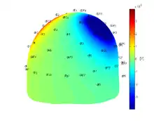 EIT Forward Problem